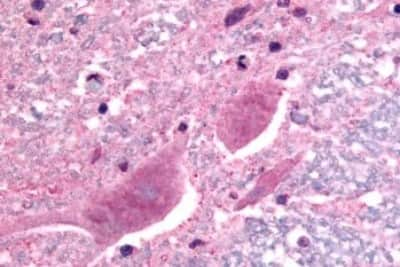 Immunohistochemistry-Paraffin: SCN3A Antibody [NBP3-14468]